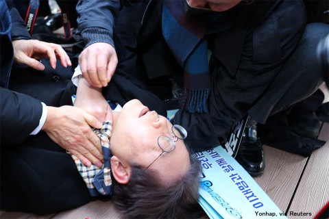 चक्कु प्रहारबाट घाइते दक्षिण कोरियाली नेता लीको स्वास्थ्यमा क्रमिक सुधार : चिकित्सक